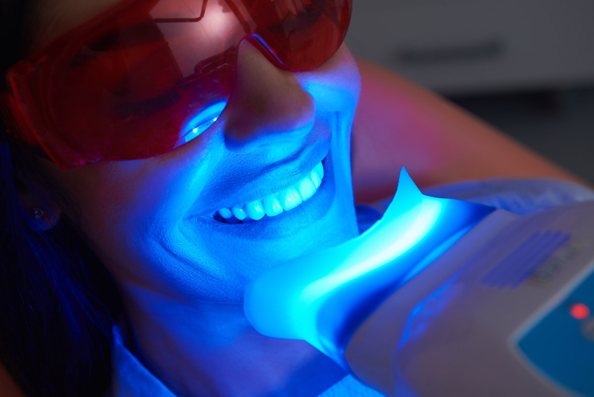 Teeth Whitening: In Office Vs At Home Options